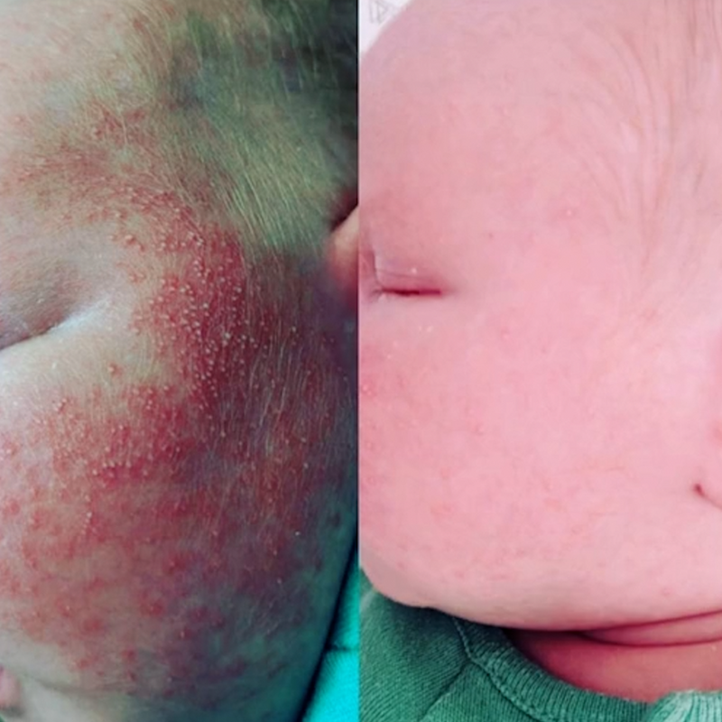 "within like 3 days his rough patches were already softer"