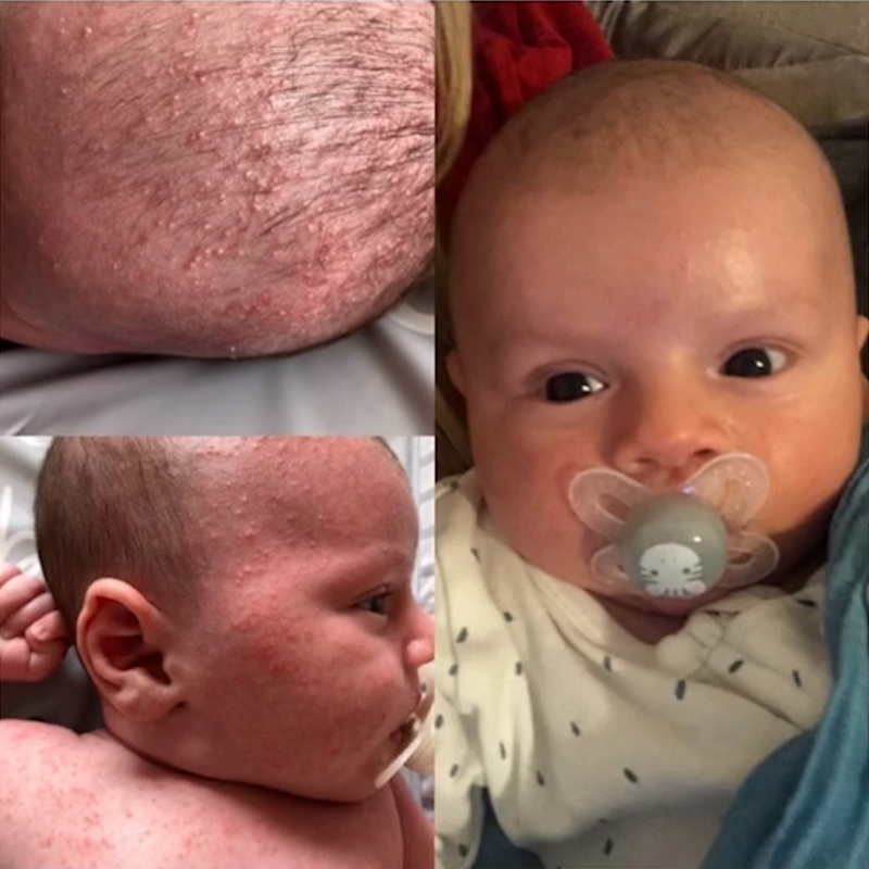 "This butter did in two weeks what 8 months of prescriptions couldn't."
